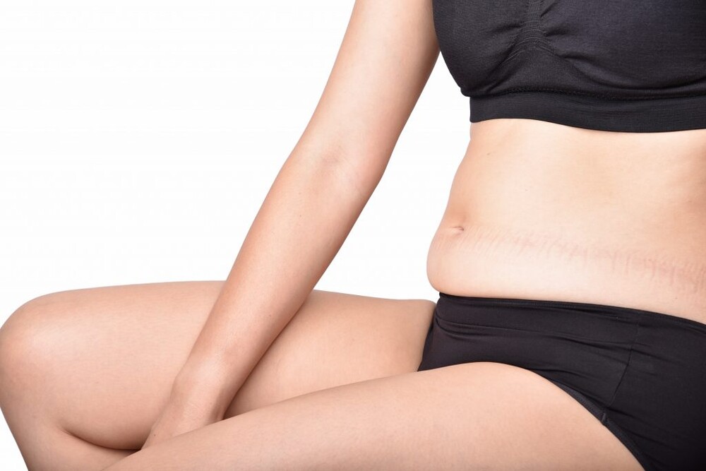 Before and After Result